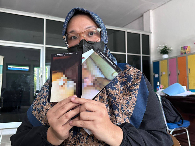 PP menunjukkan kondisi alat kelamin anaknya usai disunat. Foto: Teri/Hi!Pontianak