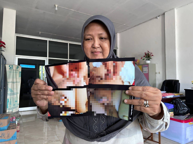 Dewi Ari Purnamawati, kuasa hukum korban, menunjukkan foto-foto kondisi alat kelamin korban usai diduga menjadi korban malapraktik klinik sunat di Pontianak. Foto: Teri/Hi!Pontianak 