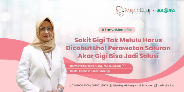 Sakit Gigi Tak Harus Dicabut Lho! Perawatan Saluran Akar Gigi Bisa Jadi Solusi