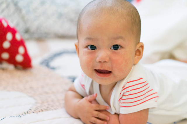 Mengapa Perawatan Kulit Bayi Tidak Bisa Sembarangan? Foto: MIA Studio/Shutterstock