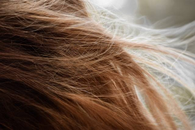 Ilustrasi Tempat Tumbuh Rambut di Kepala yang Bentuknya Melingkar. Foto: dok. Taylor Smith (Unsplash)