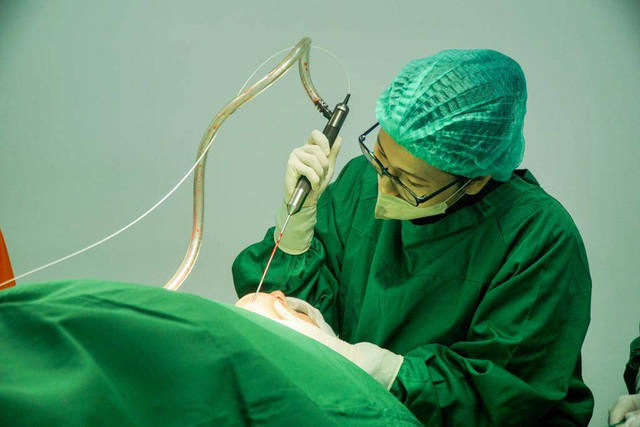 Fat Graft, Prosedur Transfer Lemak yang Bisa Bikin Awet Muda