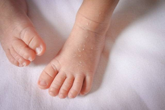 Ilustrasi bayi. (foto: Shutterstock)