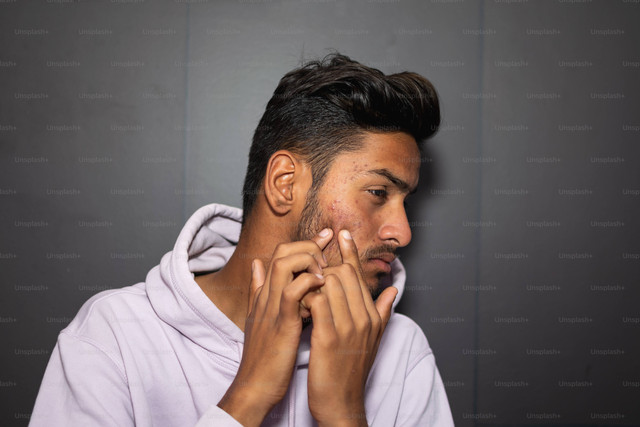 Ilustrasi Cara Mengatasi Bruntusan di Dahi dengan Sabun. Foto: Unsplash/Unsplash+