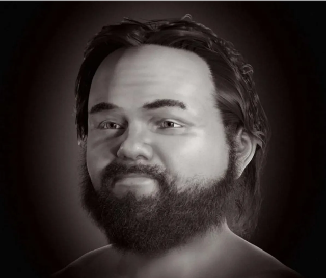 Rekonstruksi wajah pria pengidap dwarfisme pertama yang hidup 1.000 tahun lalu.  Foto: Moraes dkk./bioRxiv