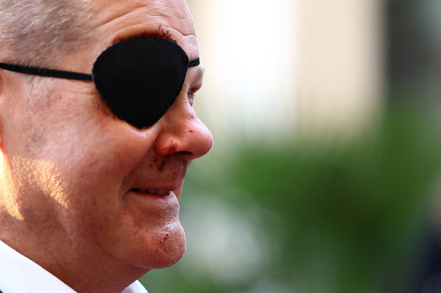 Kanselir Jerman Olaf Scholz mengenakan penutup mata setelah mengalami cedera saat joging di Berlin, Jerman, 4 September 2023. Foto: REUTERS/Lisi Niesner