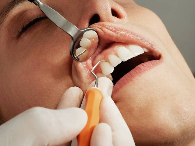 Apa saja ruang lingkup pekerjaan Asisten Dental?. Foto hanya ilustrasi. Sumber foto: Unsplash/Caroline Lm