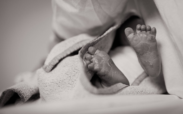 Cara Mengatasi Kaki Kering, Unsplash/🇸🇮 Janko Ferlič