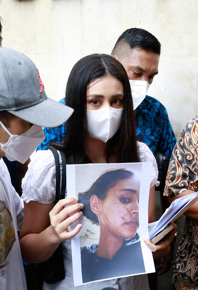 Selebgram Afifah Riyad bersama kuasa hukum ditemui wartawan usai menanyakan perkembangan terkait kasus penganiayaan di Polda Metro Jaya, Jakarta, Jumat (27/10/2023).
Foto: Dok. Agus Apriyanto