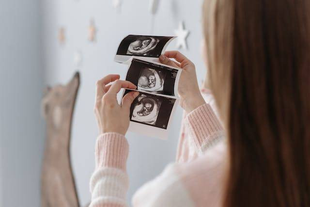 Cara Membaca Hasil USG 2D Trimester 1. Sumber: Pavel Danilyuk/Pexels