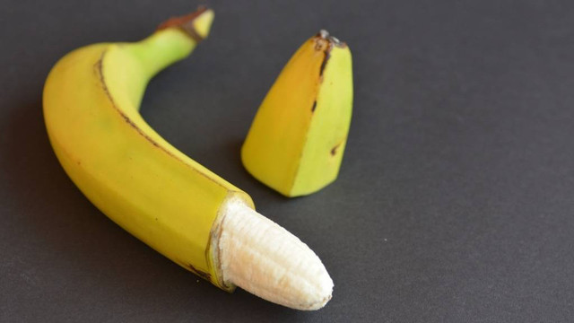 Ilustrasi sunat. Foto: Shutterstock