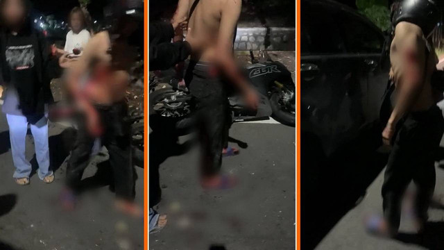 Tangkapan layar korban pembacokan di Desa Mojoranu, Kecamatan Dander, Kabupaten Bojonegoro, Jawa Timur. Minggu (10/12/2023) (Aset: Istimewa)
