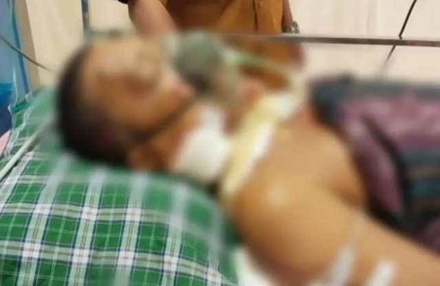 Kades di Kolaka korban pembacokan ODGJ dirawat di rumah sakit.