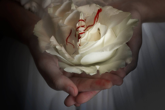 Ilustrasi sunat perempuan. Foto: Sasca/Shutterstock