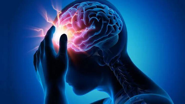 Ilustrasi epilepsi. Foto: Pixabay