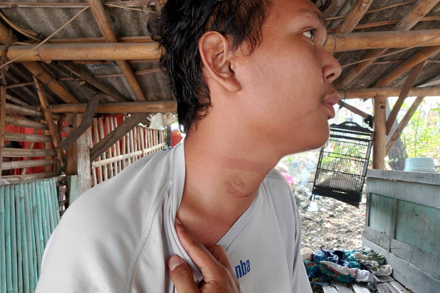 Korban yang terjerat kabel Kabel fiber optik di Bekasi Utara, Kota Bekasi. Foto: Dok. Istimewa