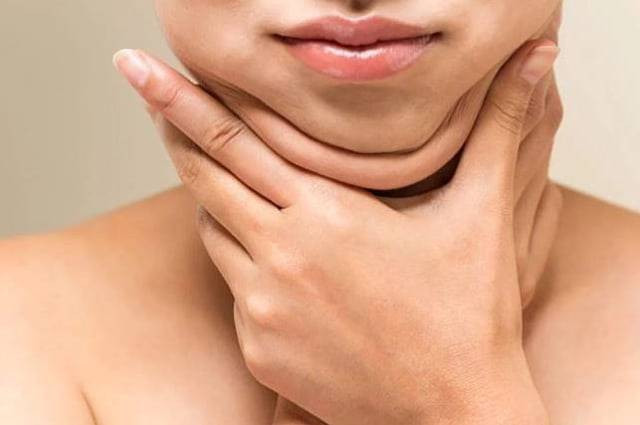 Ilustrasi cara menghilangkan lemak di dagu. Foto: Shutterstock/Kumparan.