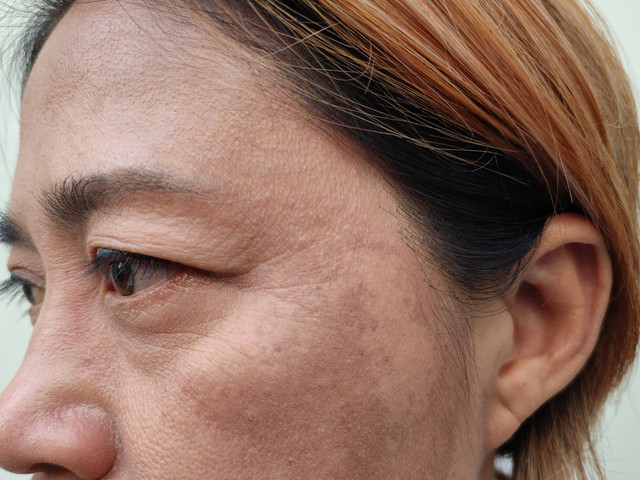 Ilustrasi Kulit Usia 50 Tahun ke Atas. Foto: Shutterstock