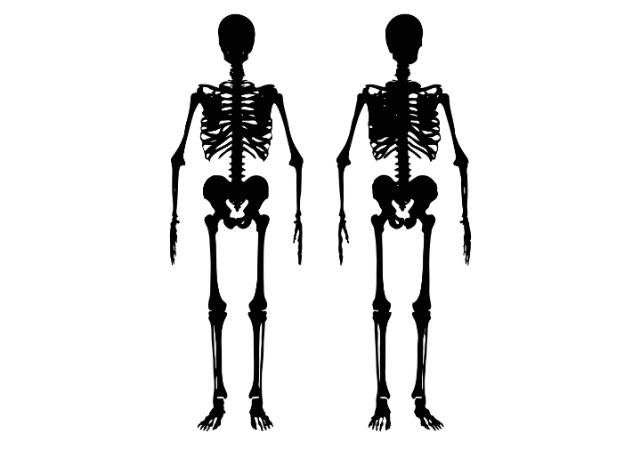 Ilustrasi tulang anggota gerak bawah. Sumber foto: pixabay/BedexpStock