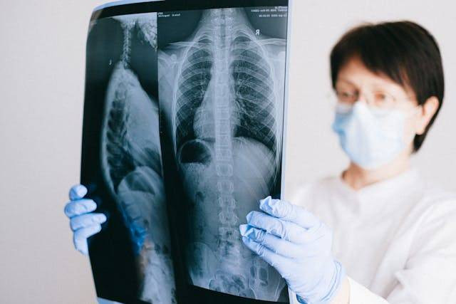 Fungsi alveolus. Sumber: pexels.com