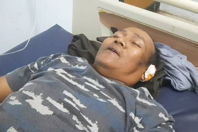 Sopir bus yang alami kecelakaan di Ciater, Subang Foto: Dok. kumparan