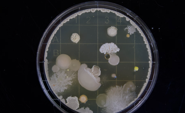 Ilustrasi euglena adalah. Sumber: Unsplash/Michael Schiffer