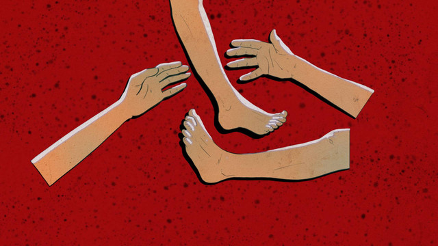 Ilustrasi mutilasi. Foto: Fatah Afrial/kumparan