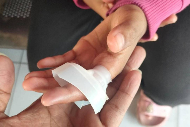 Evakuasi botol plastik yang menyangkut di jari seorang anak. Foto: Instagram/ @humasjakfire