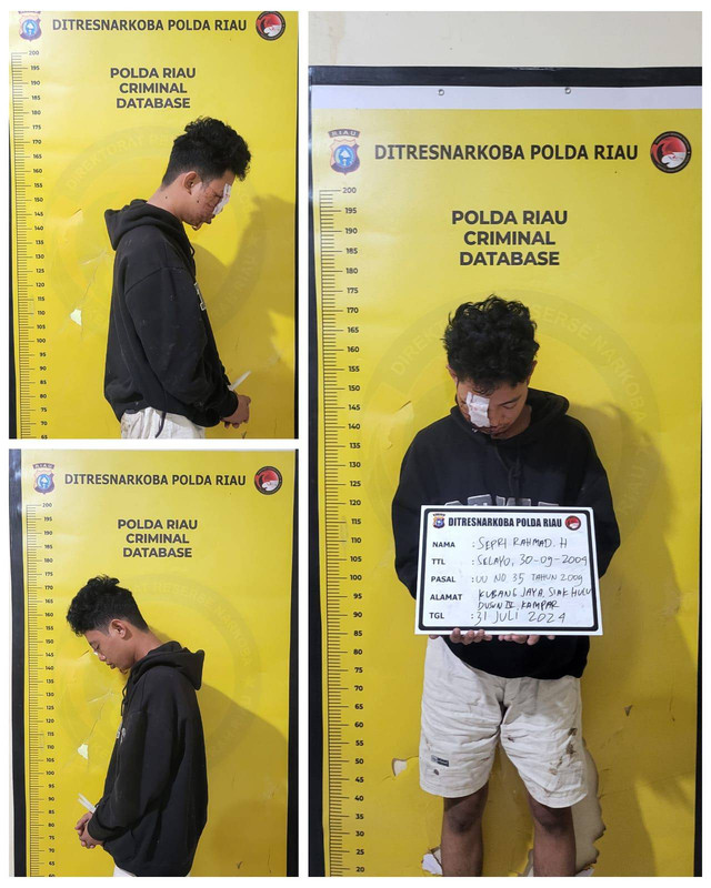 Kurir sabu 1 kg berinisial SRH (20 tahun) di Pekanbaru menabrak pohon, wajah harus dijahit. Foto: Dok. Istimewa