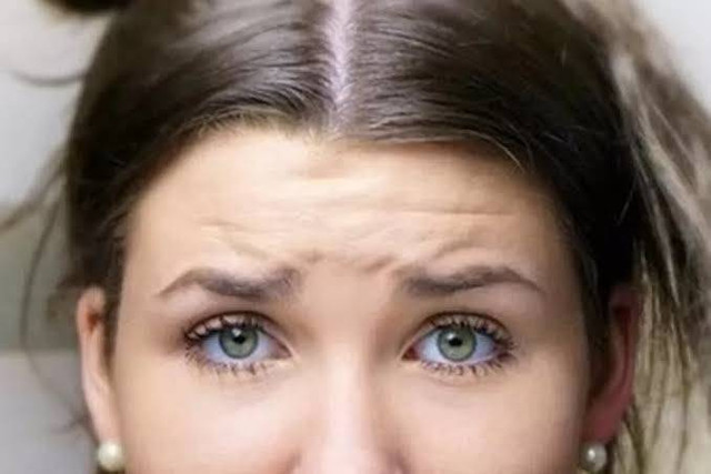 Ilustrasi penuaan dini. Foto: Pixabay