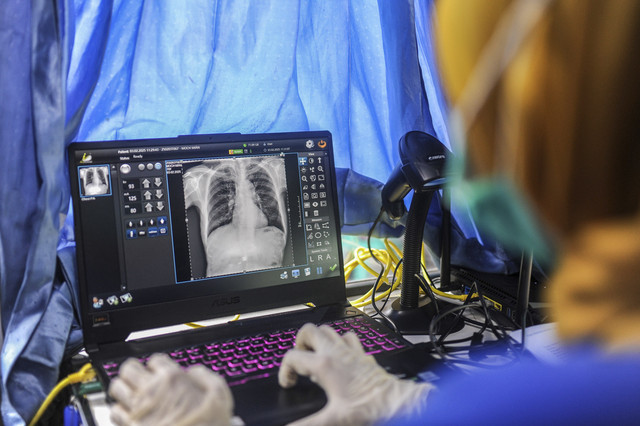 Petugas kesehatan mengamati hasil rontgen thorax saat layanan keliling deteksi Tuberkulosis di Kelurahan Karundang, Kota Serang, Banten, Senin (3/1/2025). Foto: Muhammad Bagus Khoirunas/ANTARA FOTO