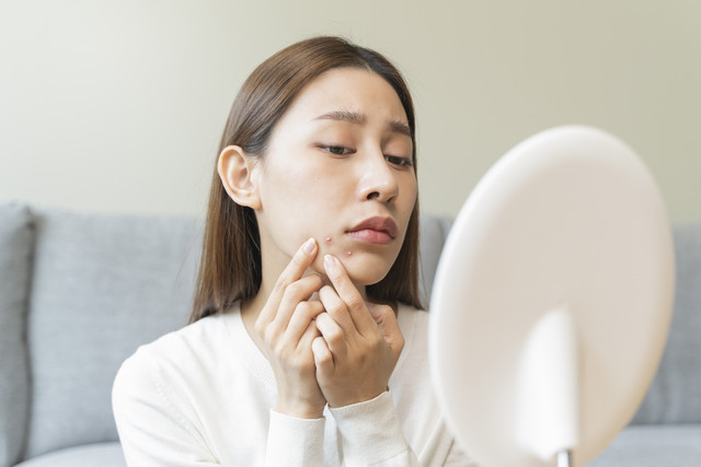Ilustrasi kandungan Benzena dalam skin care jerawat. Foto: Pormezz/Shutterstock 