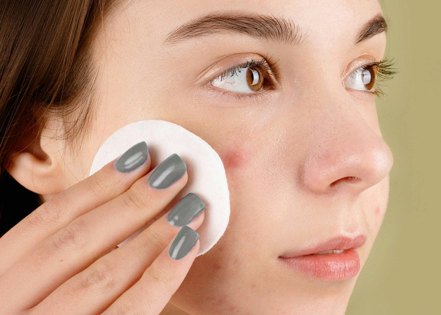 Ilustrasi rekomendasi micellar water untuk kulit berjerawat - Sumber: pexels.com/@anna-nekrashevich/