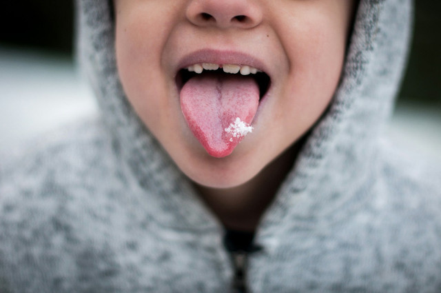 Ilustrasi sariawan. Foto: Pexels