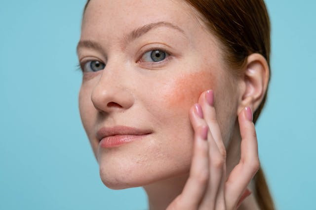 Ilustrasi warna blush on untuk kulit sawo matang. Sumber foto: Pexels/Ron Lach