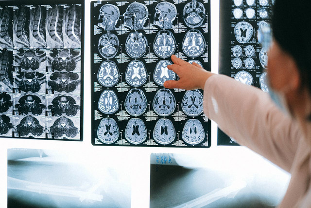 Ilustrasi perbedaan CT scan dan MRI. Foto: Pexels.com