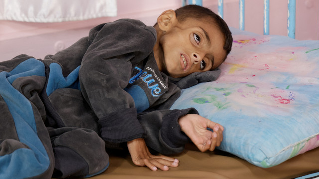 Seorang anak Palestina Osama Al-Reqep, 5 tahun, terbaring di ranjang di Rumah Sakit Nasser tempat ia menerima perawatan, di Khan Younis, di Jalur Gaza selatan, 1 Mei 2025. Foto: REUTERS/Hatem Khaled