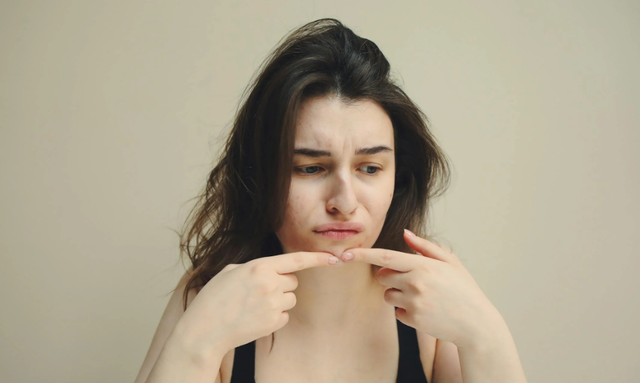 Ilustrasi Skincare Skintific untuk Jerawat. Sumber: Pexels/Polina Tankilevitch