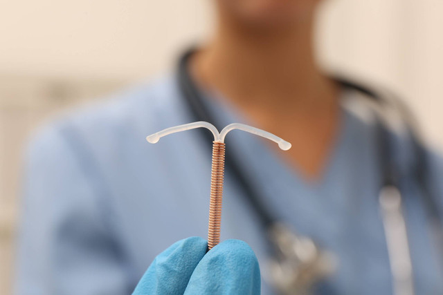  Ilustrasi KB IUD. Foto: New Africa/Shutterstock