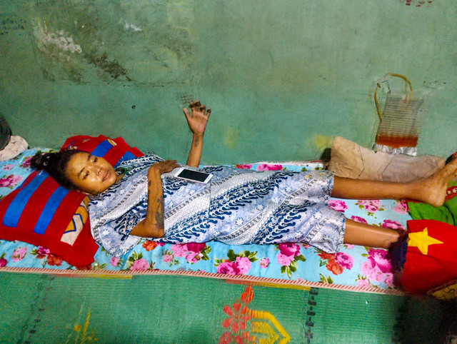 Ratih (30), ibu empat anak yang lumpuh diduga akibat malpraktik medis di RSUD Bekasi. Foto: Dok. Istimewa