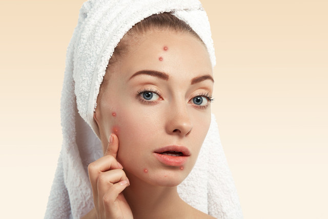 Ilustrasi rekomendasi acne patch di apotek. Sumber: freepik/wayhomestudio