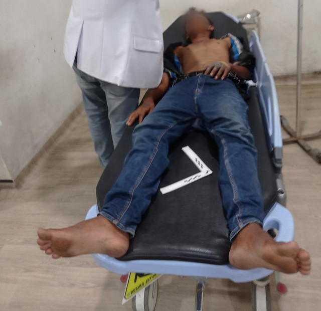 Pria di Deli Serdang diduga dibakar oleh ASN lantaran mencuri ubi.  Foto: Dok. Istimewa