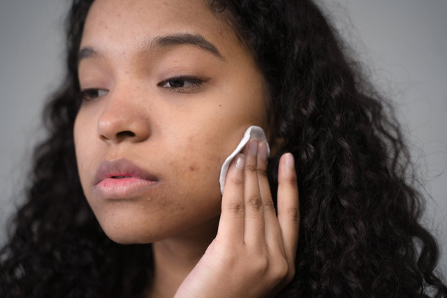 Ilustrasi menggunakan skincare untuk menghilangkan flek hitam. Foto: Pexels