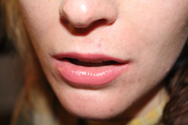 Ilustrasi Bibir, Foto:Unsplash/Omar Shishani