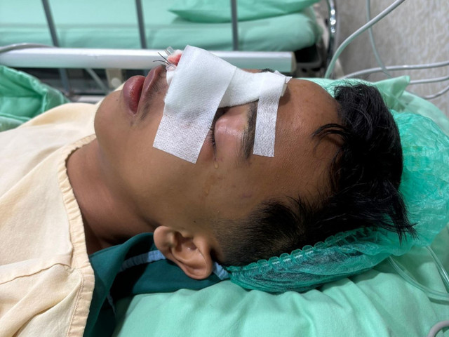 Ferly Landra Savero, siswa kelas 1 SMA Negeri 9 Kota Pekanbaru, Riau, korban bullying dan pengeroyokan oleh sesama siswa. Foto: Dok. Istimewa