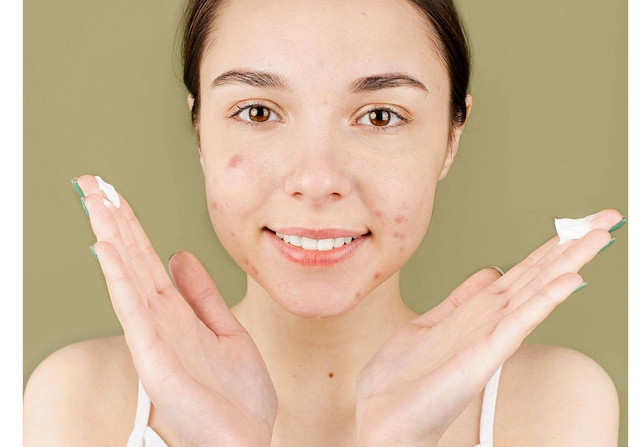 ilustrasi sabun cuci muka penghilang jerawat - foto:pexels/anna-nekrashevich