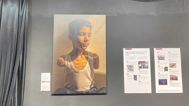 Foto seorang anak Gaza yang kehilangan kedua lengan tangannya di pameran World Press Photo 2025 Pontianak. Foto: Alycia Tracy Nabila/Hi!Pontianak