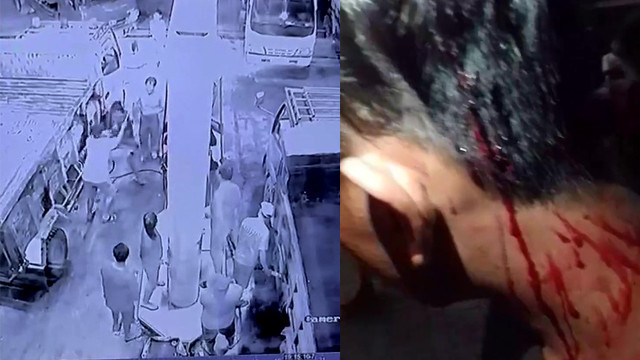 Kolase rekaman CCTV yang memperlihatkan aksi penganiayaan dan kondisi korban yang berdarah di bagian kepala akibat dipukul menggunakan benda diduga besi. (foto: tangkapan layar video akun facebook Jheky)