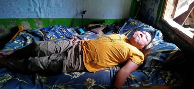 Kondisi Kang Endud yang sudah menderita polio sejak usia 8 tahun (Sumber : DT Peduli)