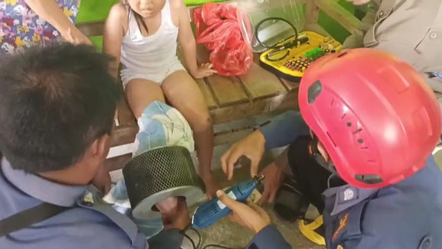 Kaki bocah yang tersangkut filter udara mobil. | Foto: Dok Istimewa